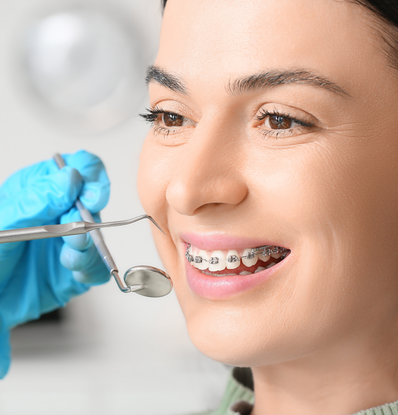 Orthodontic Treatments