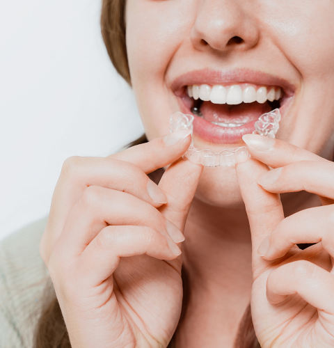Invisible Braces