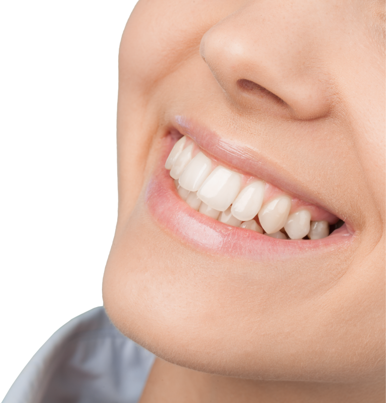 Smile Designing