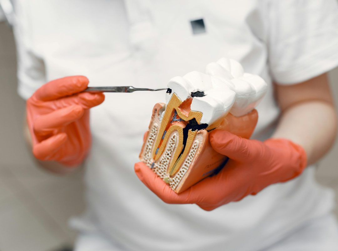 pexels-photo-4971514-4971514 Close-up of dentist holding a tooth model, illustrating dental care concepts.
