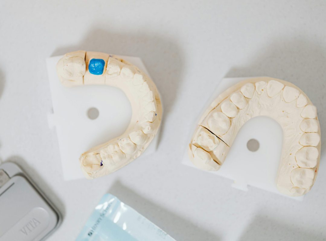pexels-photo-6627601-6627601 Close-up of dental molds on a white table, showcasing orthodontic details.